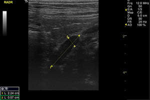 Ultrasound services in Arvada