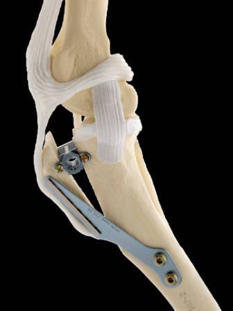 Example of a tibial tuberosity advancement procedure at Okanagan Veterinary Hospital
