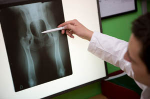 A doctor examining x-ray at Angeles Clinic For Animals in Port Angeles, Washington