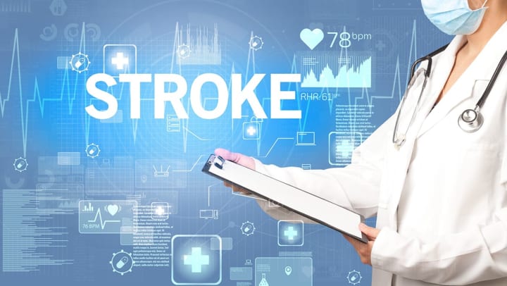 Is there a link between strokes and dementia - Anthem Memory Care